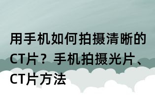 用手機如何拍攝清晰的CT片?手機拍攝光片、CT片方法