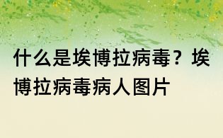什么是埃博拉病毒？埃博拉病毒病人圖片